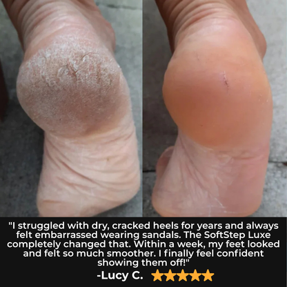 Lumora Soft Step Foot File 3.0